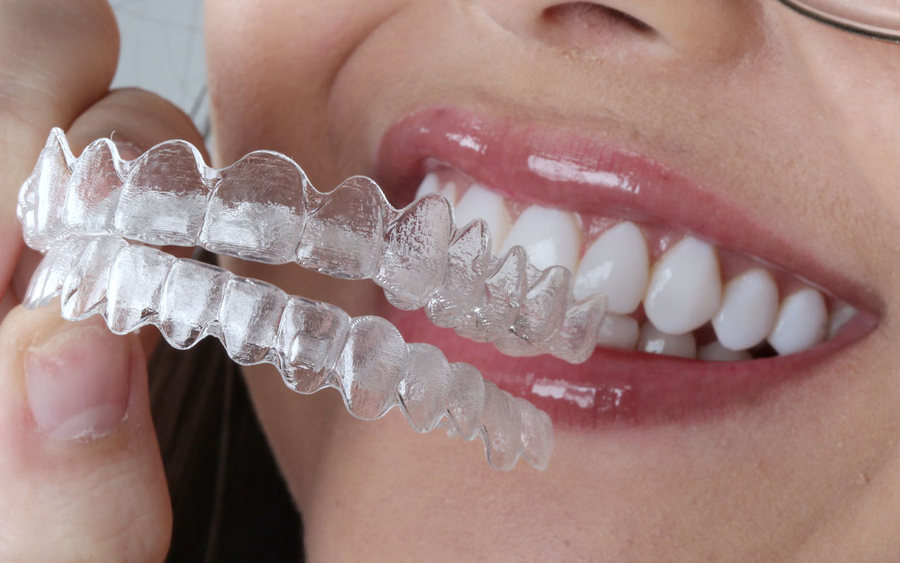 Qual a diferença do Invisalign em relação aos outros aparelhos?