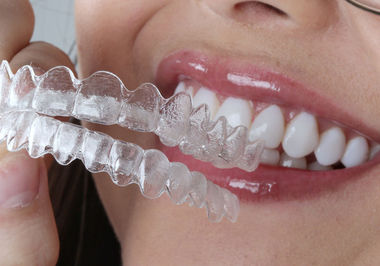 Qual a diferença do Invisalign em relação aos outros aparelhos?