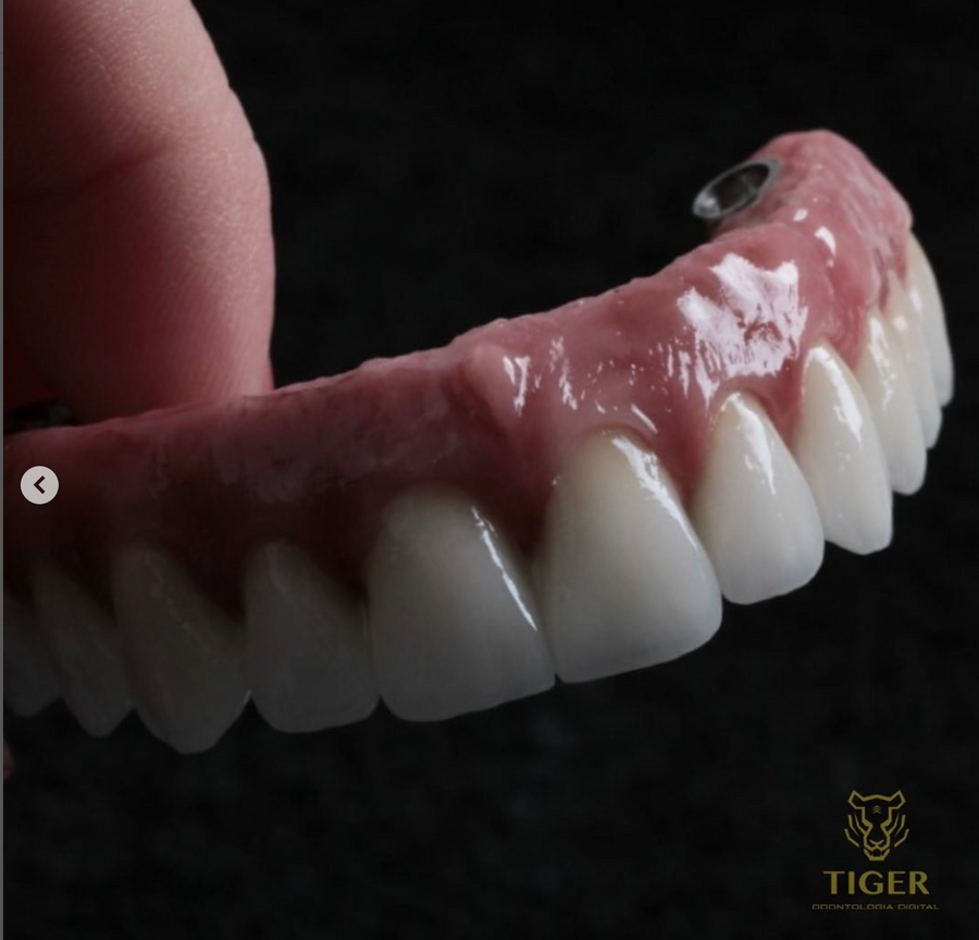 Quais cuidados se deve ter com uma Prótese dentária protocolo?