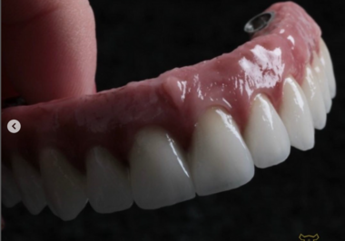 Quais cuidados se deve ter com uma Prótese dentária protocolo?