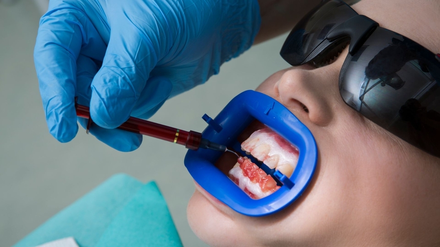 Clareamento dental: meus dentes ficarão sensíveis?