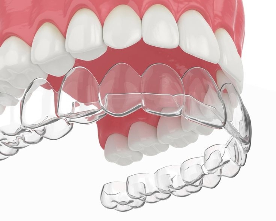 O Tratamento com Invisalign