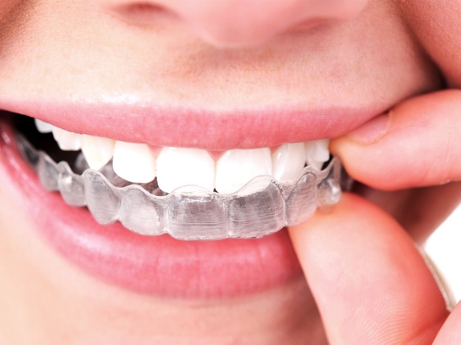 Ortodontia Corretiva: Muito Além de Alinhar os Dentes