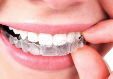 Ortodontia Corretiva: Muito Além de Alinhar os Dentes