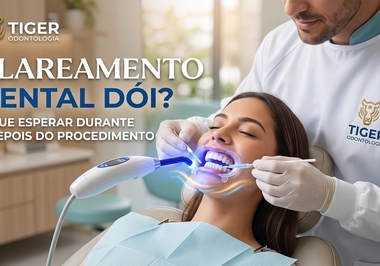 Clareamento Dental Dói? O Que Esperar Durante e Depois do Procedimento